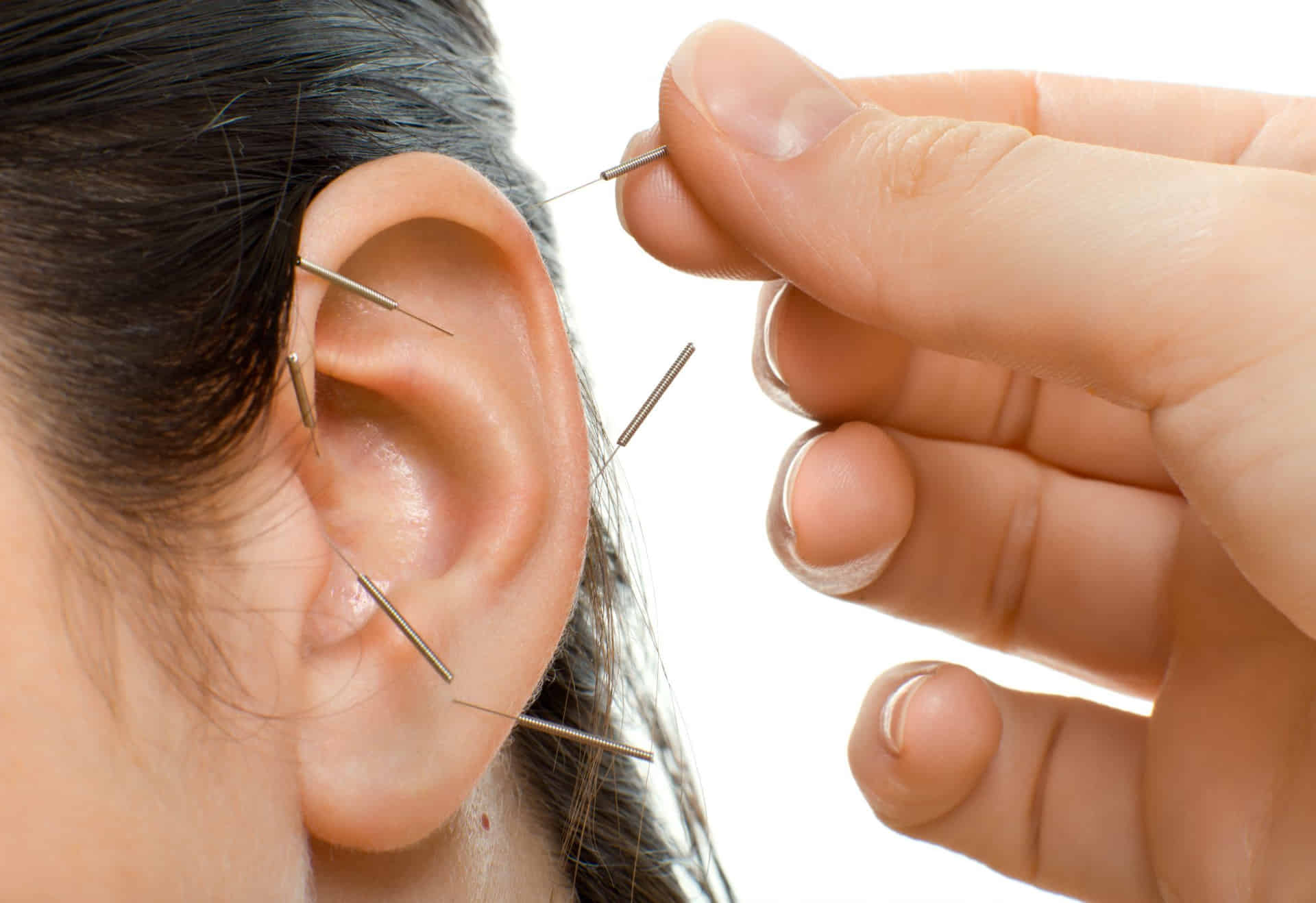 tratamiento auriculoterapia barcelona