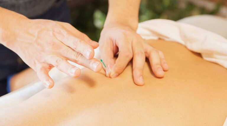 beneficios-acupuntura